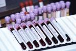 В Волгоградской области обновят станции переливания крови