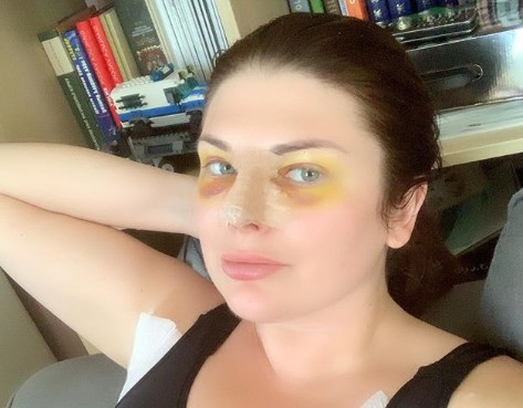 30-летняя модель plus-size Юлия Рыбакова легла под нож пластического хирурга