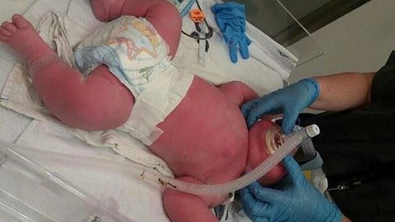 Волгоградская медсестра ответит за страшные увечья младенца